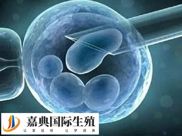 成都做人工授精的医院有哪些？费用是多少？(图1)